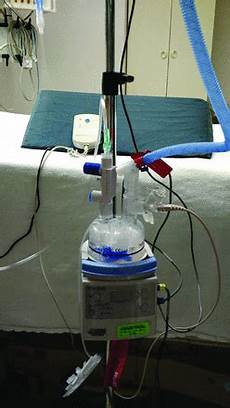 Humidification System